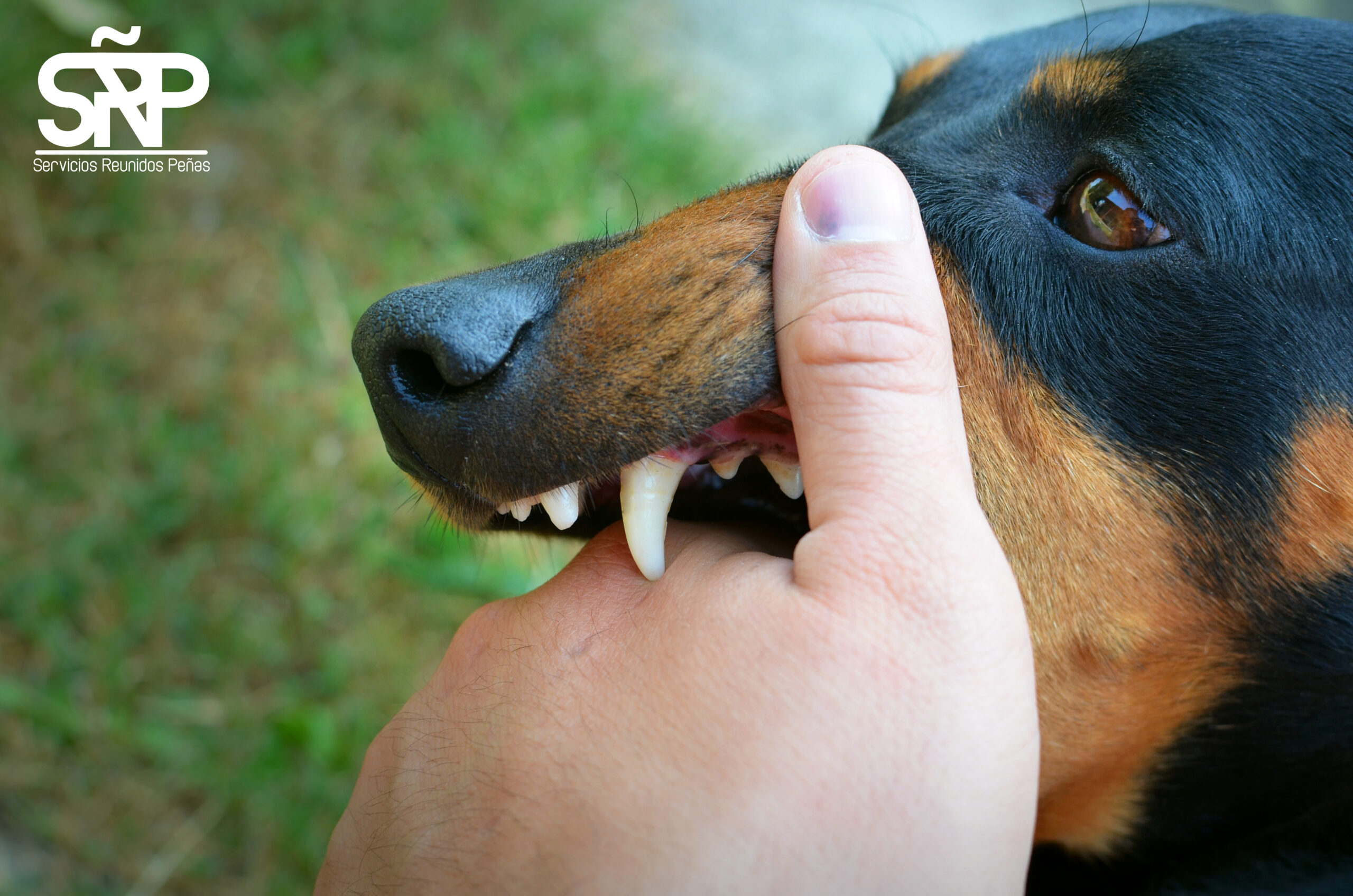 Vicious dog showing teeth and biting hand.